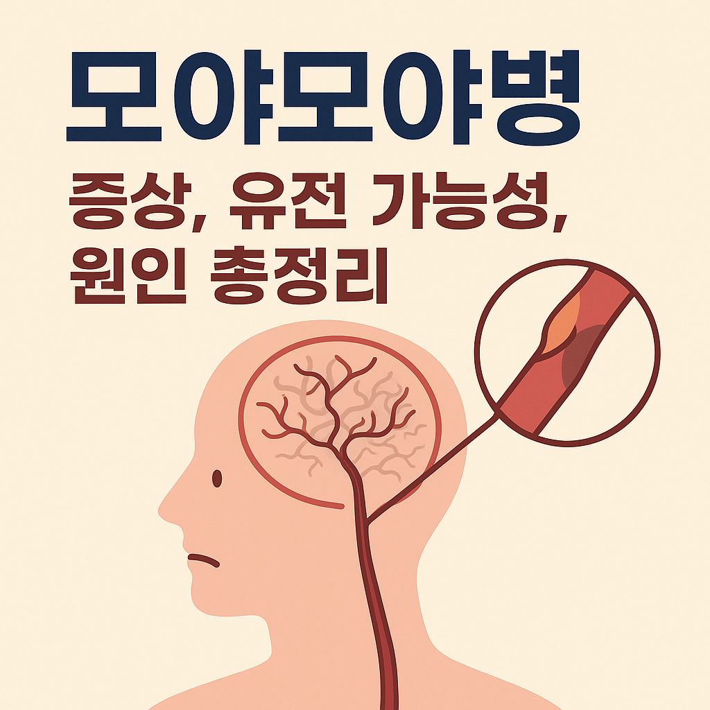 모야모야병 증상, 유전 가능성, 원인 총정리