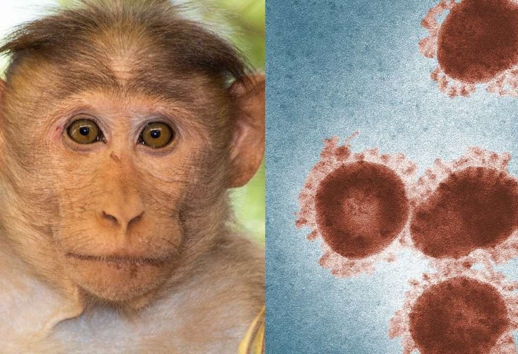 원숭이 두창 바이러스