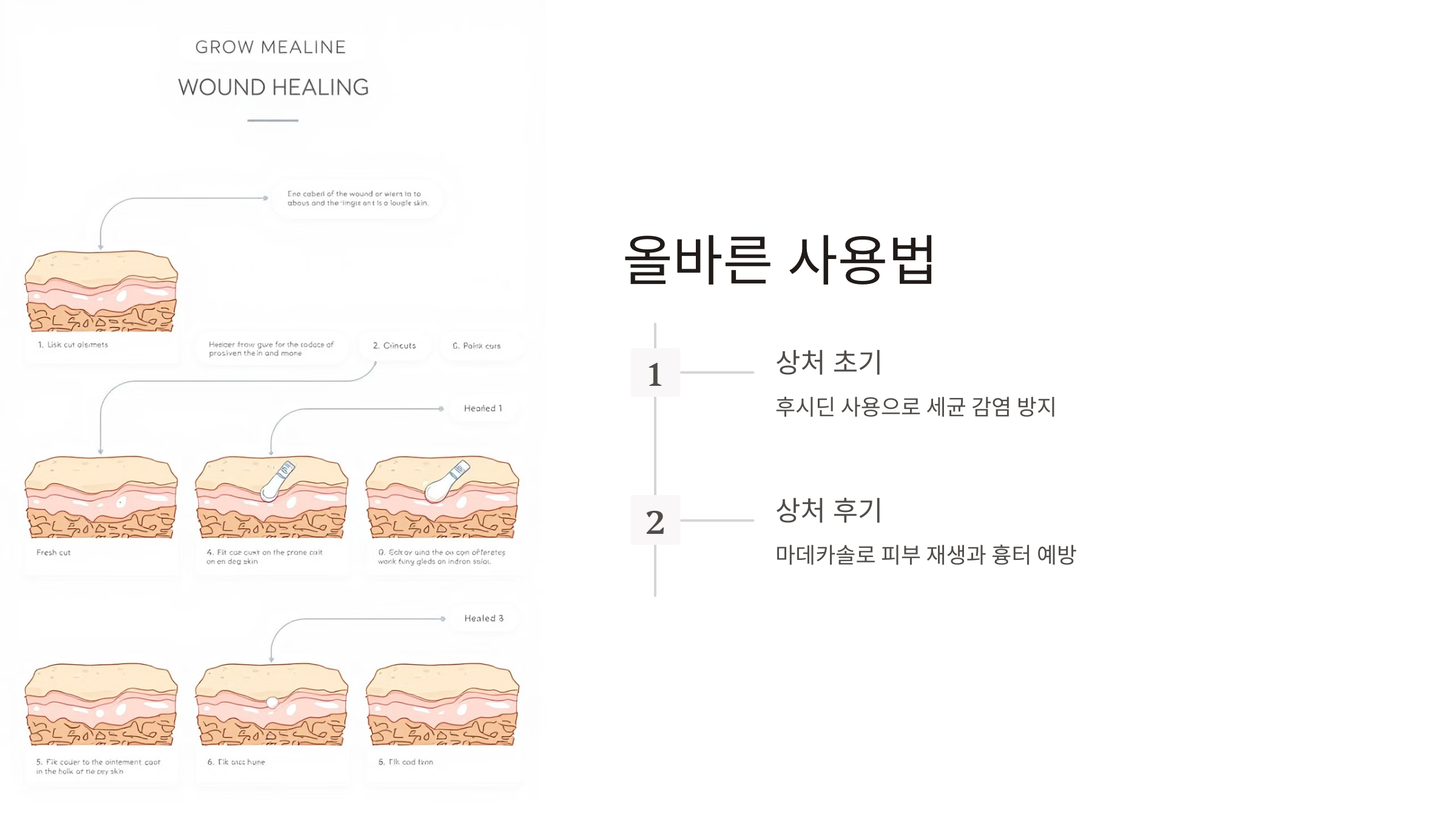 마데카솔 후시딘 차이 효능 효과 가격