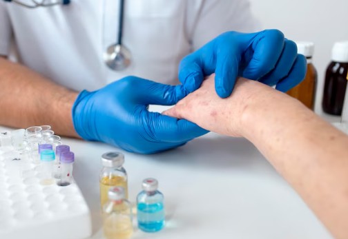 대상포진-전염-예방-수칙-전염성-6