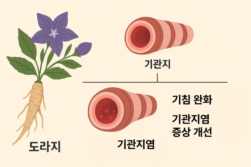 기관지염에 좋은 음식