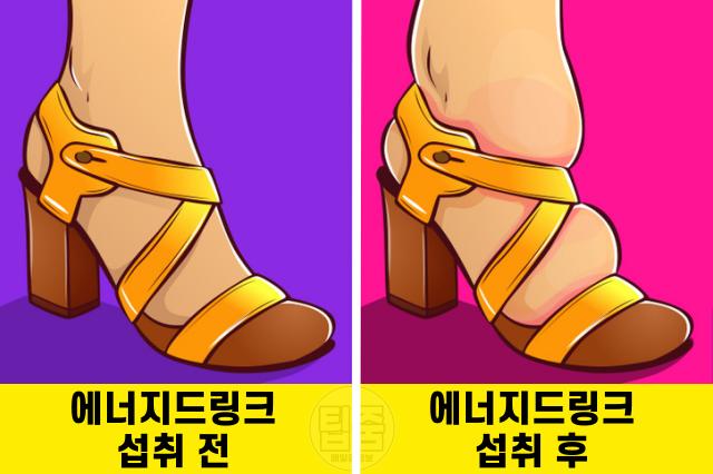 에너지드링크 부작용 카페인 붓기 부종