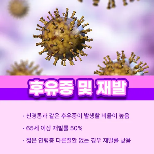 대상포진 후유증 재발