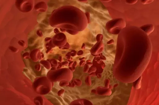 베타-시토스테롤-효능-부작용-건강