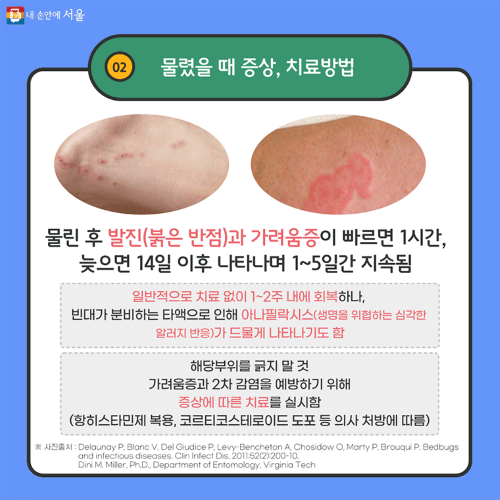 빈대 예방 증상 치료방법 체크리스트