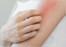 재채기&amp;#44; 콧물&amp;#44; 가려움증등의 알레르기 증상을 일으키는 사람들