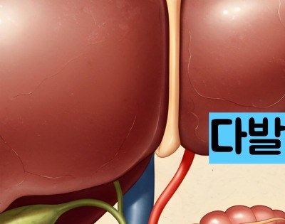 급성 췌장염 증상