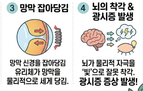 광시증 증상