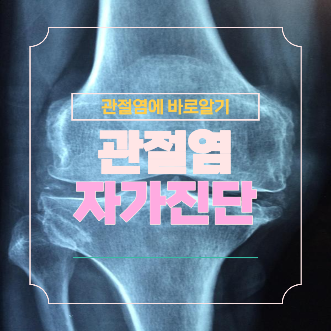 관절염 자가 진단 무료 테스트