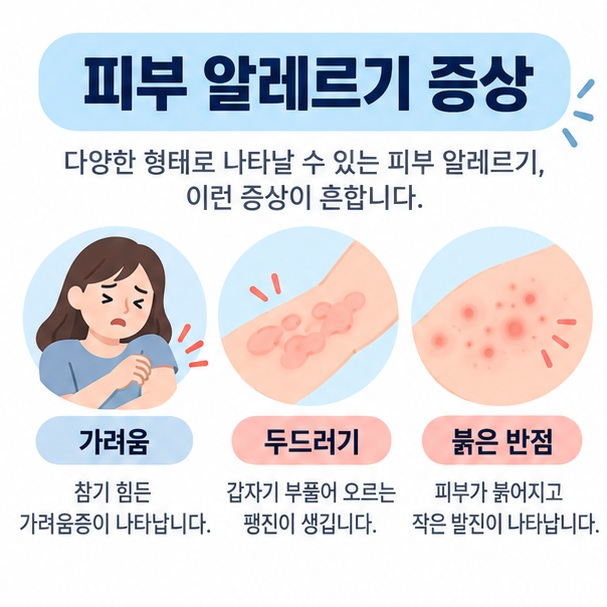 가려운 피부와 두드러기 아이콘 위에 피부 알레르기 증상 문구가 표시된 대표 이미지