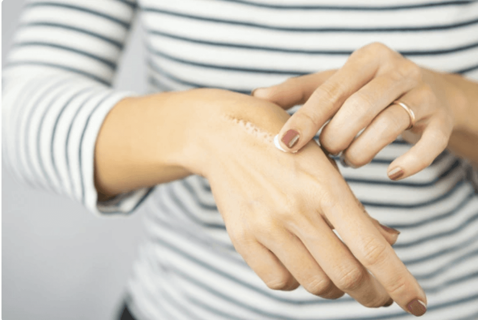 피부 재생크림과 수분크림 혼동, 여드름 흉터에는 뭐가 좋을까?