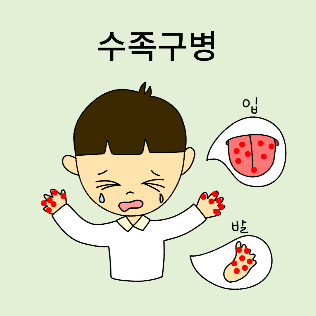 수족구병은-어린-아이들에게-취약합니다.