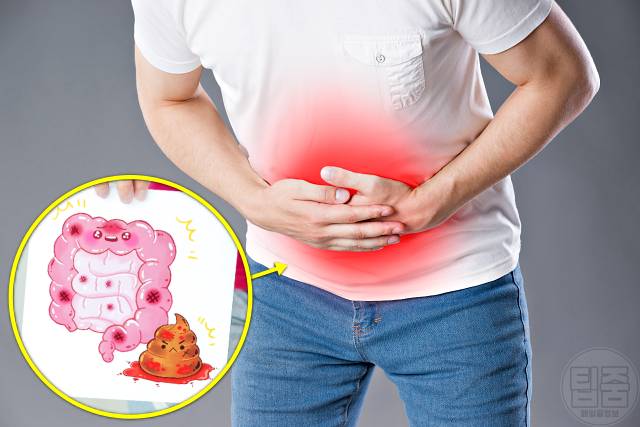 장 안좋을때 증상 복통 장 안좋으면 여드름 주사비