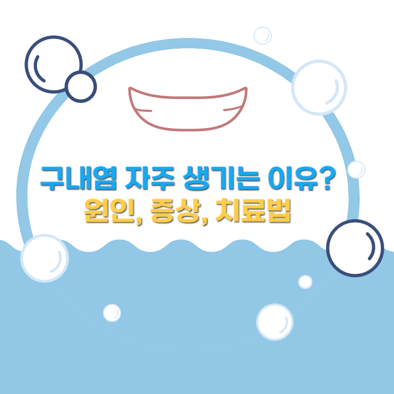 구내염 자주 생기는 이유 (구내염 원인, 증상, 치료법)