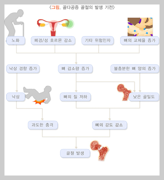 골다공증 골절 발생도