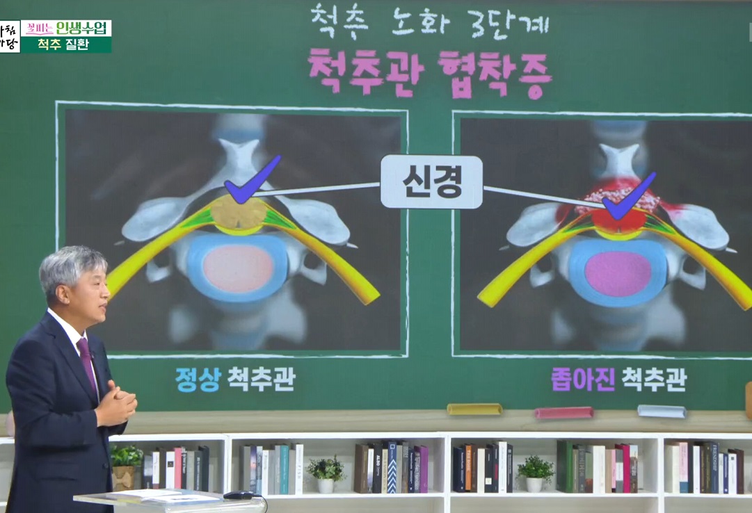 허리-진동규-교수