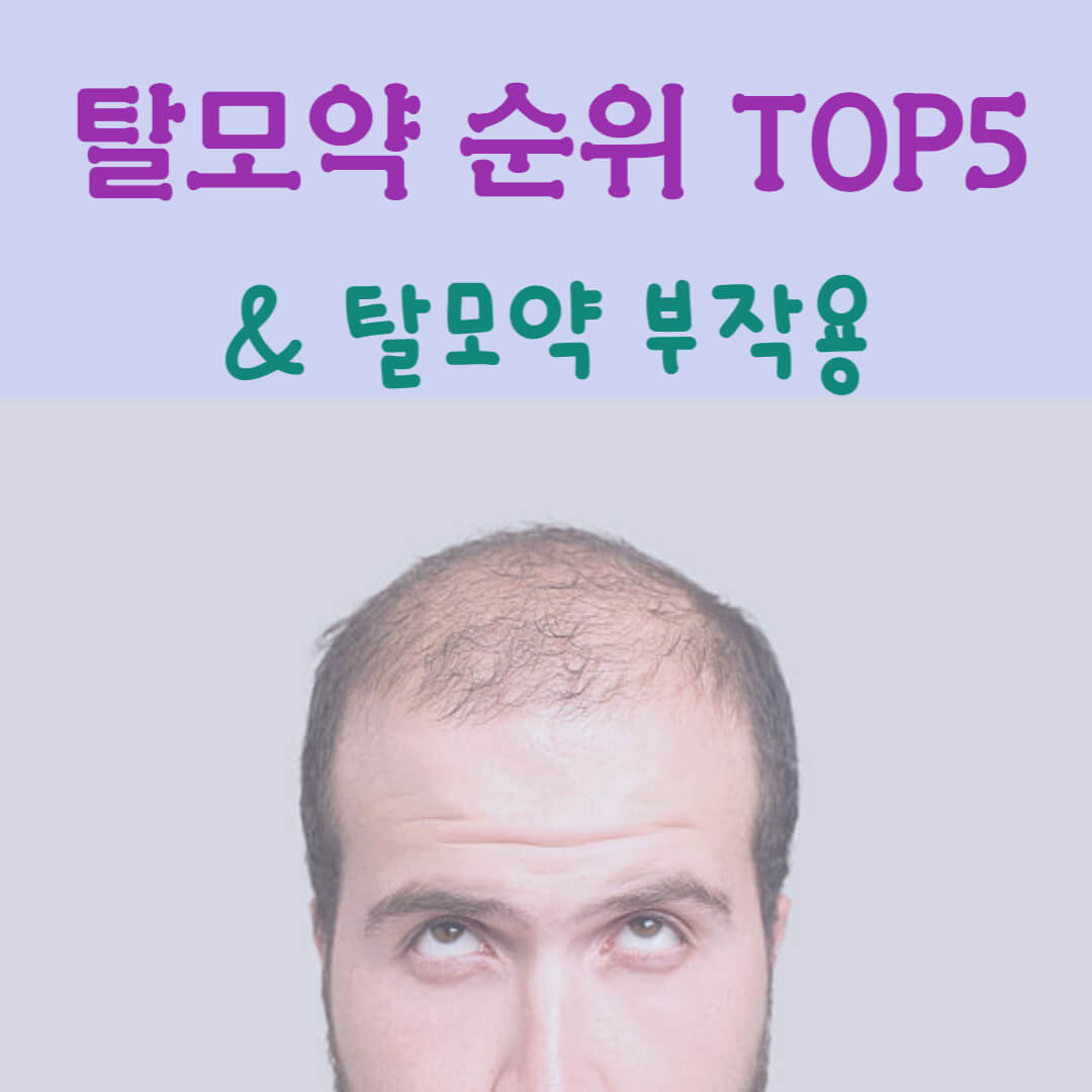 탈모약 순위 TOP5