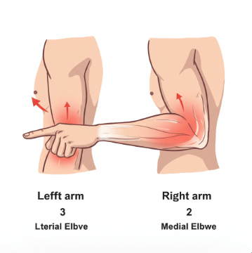 팔꿈치 통증 원인과 치료법5