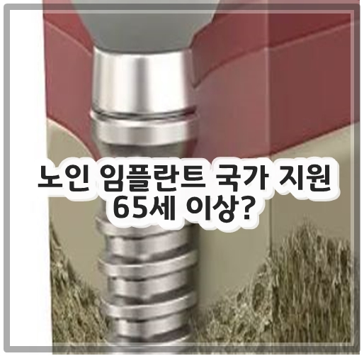 노인 임플란트 국가 지원 65세 이상?