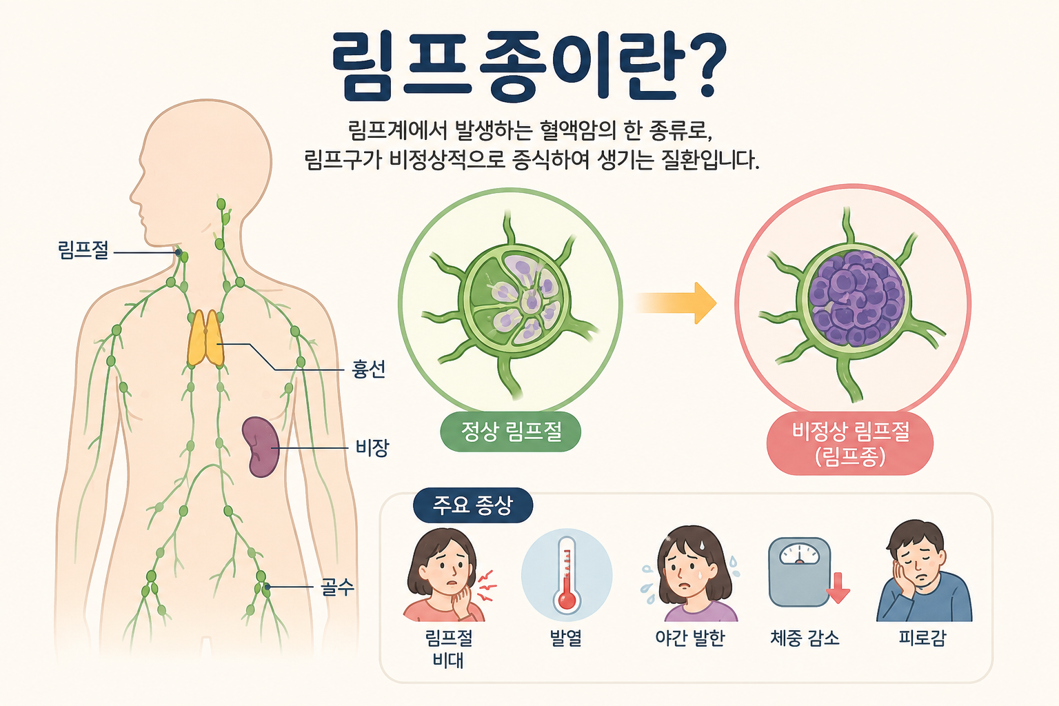 림프종
