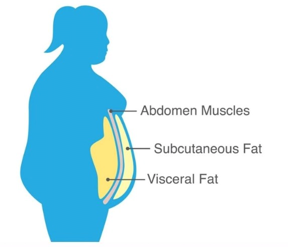 내장지방 빼는 운동 4가지