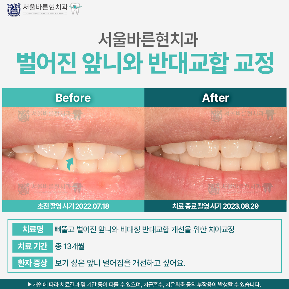 부산교정치과