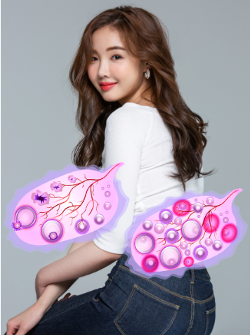 질입구 돌기 이미지