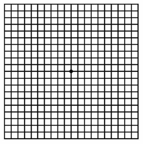 암슬러 격자무늬 테스트 자가진단법