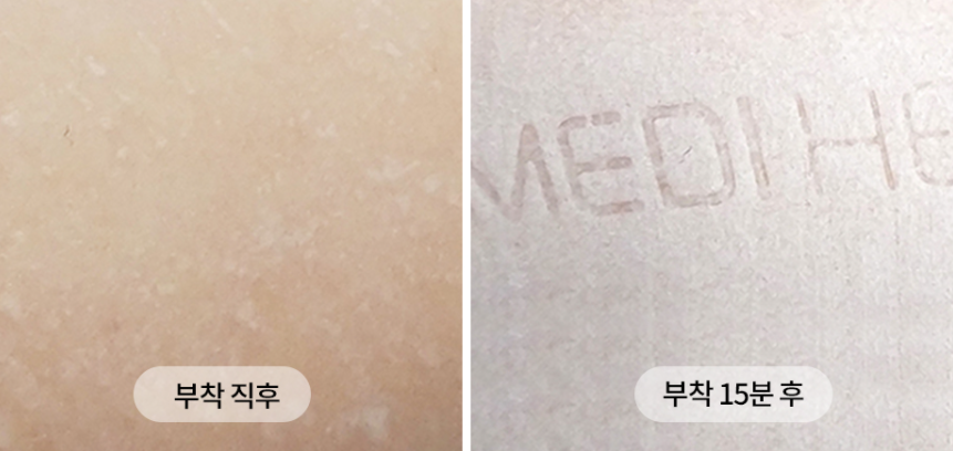 메디힐 티트리 마스크팩 효과 및 성분