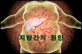 지방간이 생기는 진짜 원인