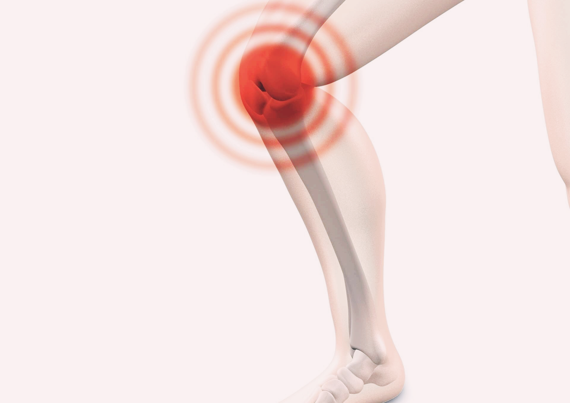 류머티즘, 퇴행성관절염