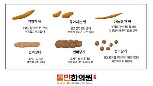 변비 탈출을 위한 종합 치료법