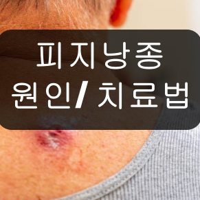 피지낭종