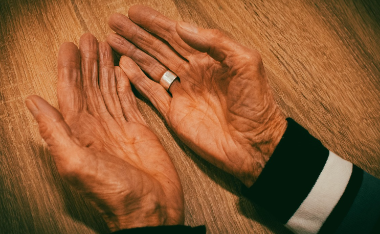 레스베라트롤_가능성