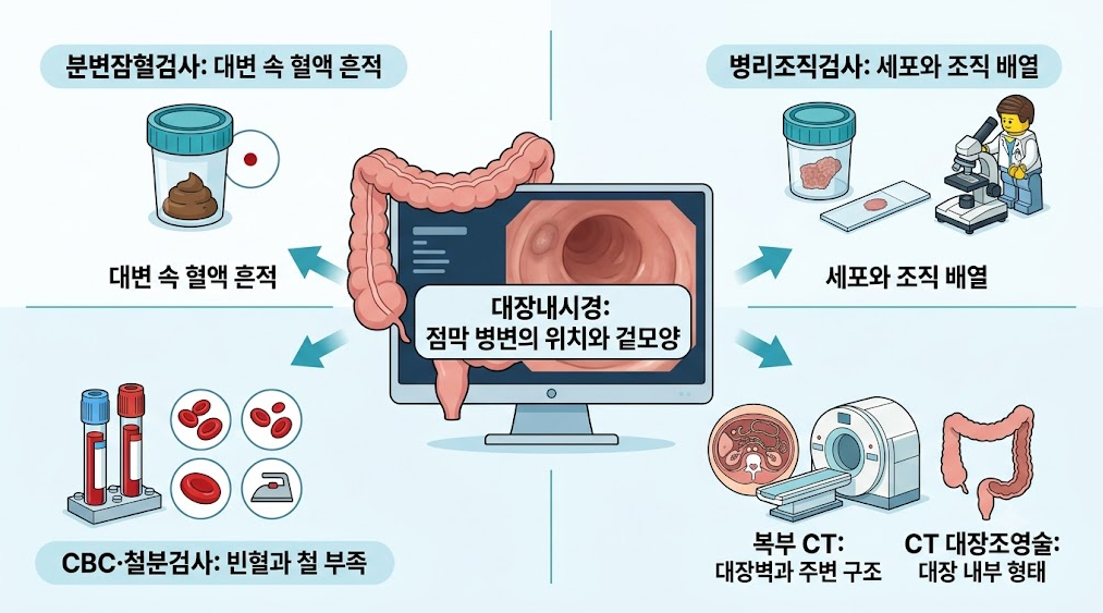 분변잠혈검사, CBC 및 철분검사, 병리조직검사, 복부 CT, CT 대장조영술 등 대장내시경과 함께 시행되는 관련 검사를 비교한 인포그래픽