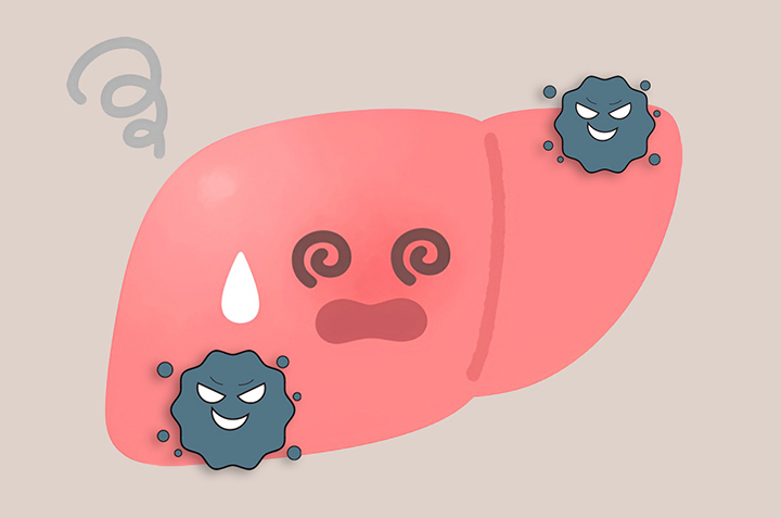 손상된-간의-모습