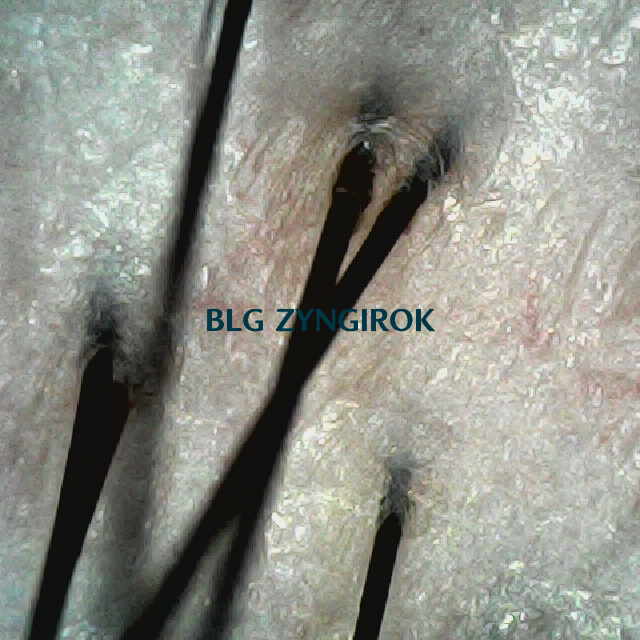 피나모아 복용 9주차 두피사진 - 뒷머리 위치이다.