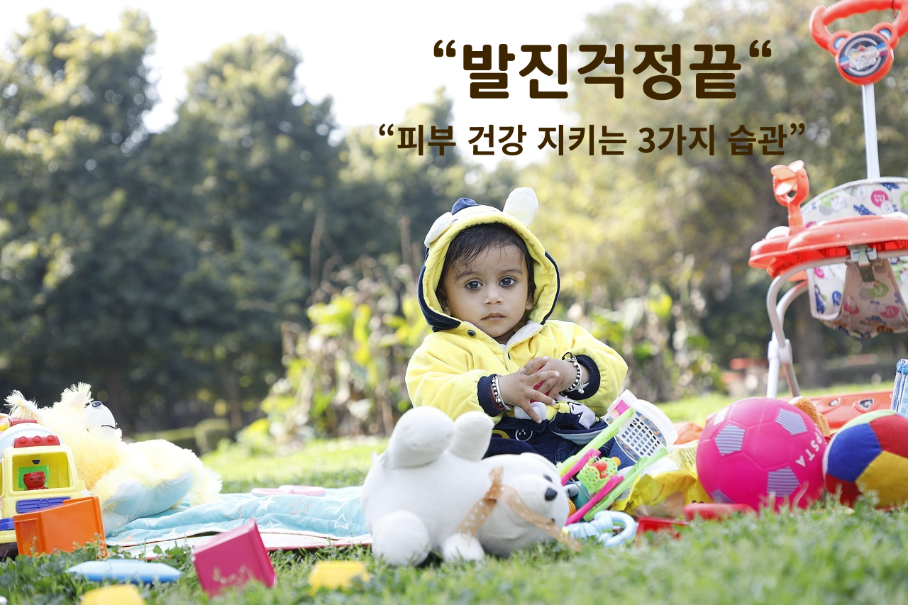아기 기저귀 발진 예방 필수템 3선