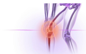 퇴행성 관절염 증상 25