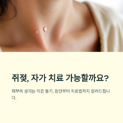 쥐젖 제거, 자가 치료 가능한가요?
