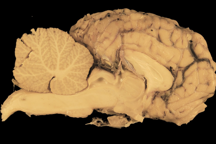 확신은 진실이 아니다: 왜 우리는 거짓 기억에 더 확신을 가지는가