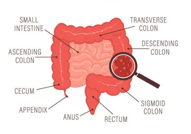 설사를 자주하는 이유