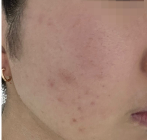 CNP 바이오디티디 스팟카밍젤 내돈내산 