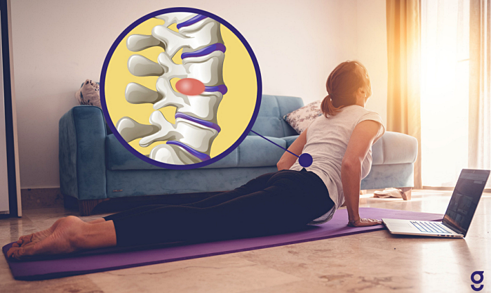 허리디스크 환자를 위한 안전하고 효과적인 7가지 운동 방법-멕켄지 운동