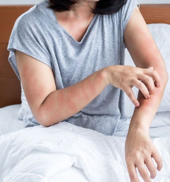 피부 건선 가려움증