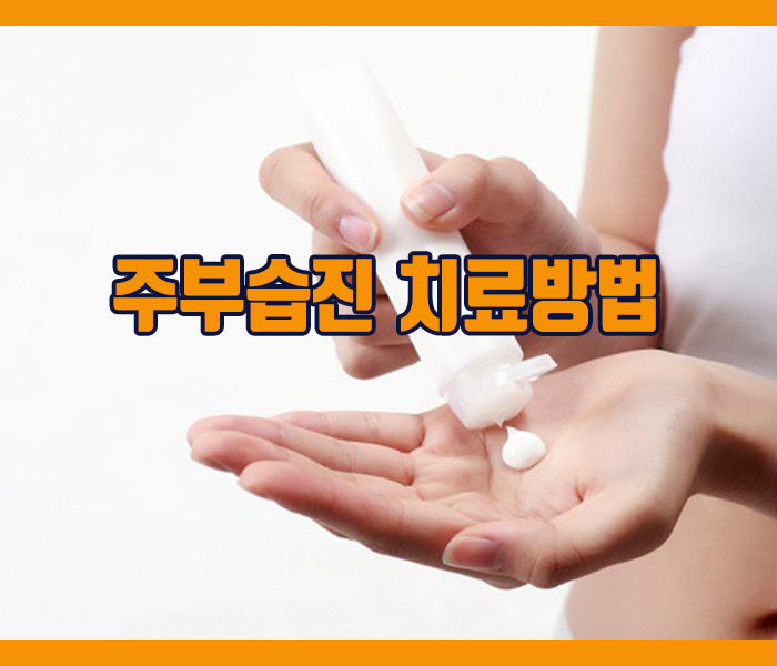 주부습진 치료방법 - 손보호장갑사용하기, 면역억제제와 항히스타민제 사용, 스테로이드 연고 사용 등