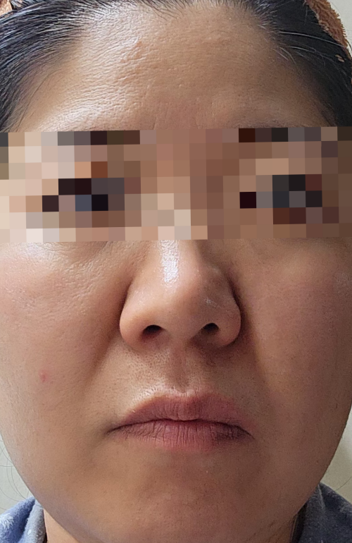 초음파사용1일차