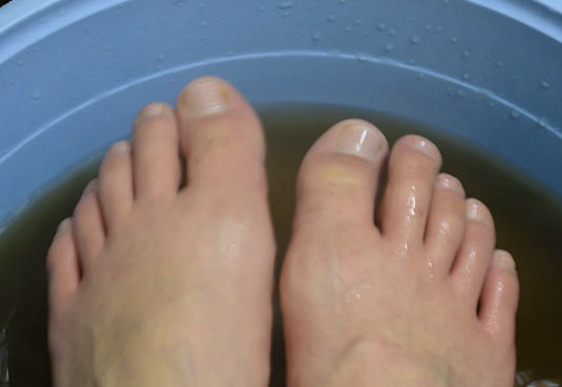 티눈 없애는 방법