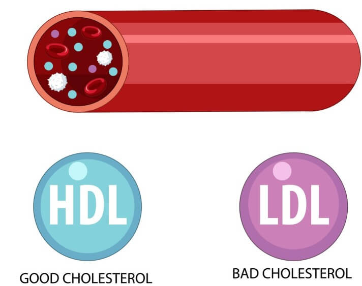 혈관 속 노폐물의 정도