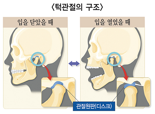 턱관절 구조